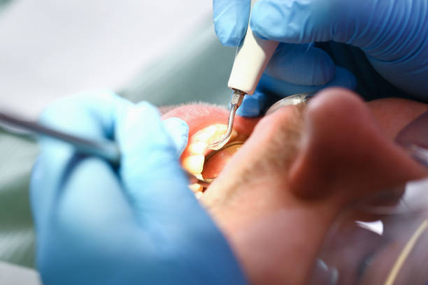 Best Emergency Denture Repair in Calvert City, KY