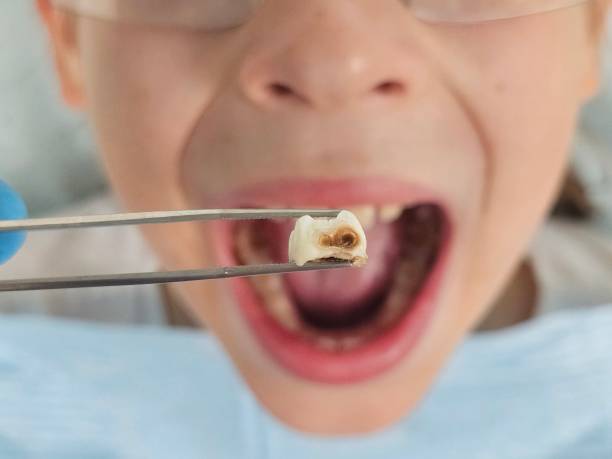 Best Urgent Dental Care for Toothaches in Calvert City, KY